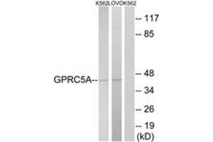 Western Blotting (WB) image for anti-G Protein-Coupled Receptor, Family C, Group 5, Member A (GPRC5A) (AA 140-189) antibody (ABIN2891081) (GPRC5A anticorps  (AA 140-189))