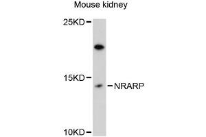 Western blot analysis of extracts of mouse kidney, using NRARP antibody (ABIN6293849) at 1:3000 dilution. (NRARP anticorps)