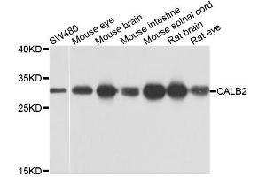 Western blot analysis of extracts of various cells, using CALB2 antibody. (Calretinin anticorps)