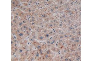 Used in DAB staining on fromalin fixed paraffin- embedded liver tissue