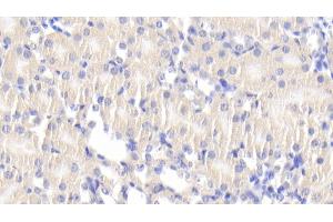 Detection of DLAT in Mouse Kidney Tissue using Polyclonal Antibody to Dihydrolipoyl Transacetylase (DLAT) (DLAT anticorps  (AA 368-626))