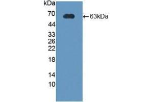 Figure. (CRHBP anticorps  (AA 25-322))