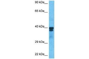 Host:  Rabbit  Target Name:  PAX6  Sample Type:  786-0 Whole Cell lysates  Antibody Dilution:  1. (PAX6 anticorps  (C-Term))