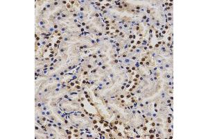 Immunohistochemistry of paraffin-embedded rat kidney tissue using PELP1 antibody at dilution of 1:200 (x400 lens). (PELP1 anticorps  (AA 1021-1180))