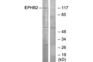Western blot analysis of extracts from Jurkat cells, using EPHB2 Antibody. (EPH Receptor B2 anticorps  (AA 991-1040))