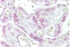 Immunohistochemistry with Placenta tissue at an antibody concentration of 10µg/ml using anti-CHEK2 antibody (ARP30290_P050) (CHEK2 anticorps  (N-Term))
