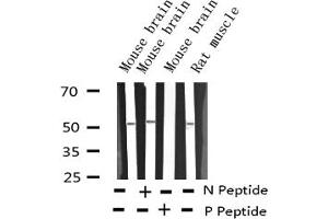 Western blot analysis of Phospho-ATF2 (Ser62 or 44) expression in various lysates (ATF2 anticorps  (pSer44, pSer62))