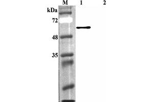 Western blot analysis using anti-FTO (human), pAb  at 1:4'000 dilution. (FTO anticorps)