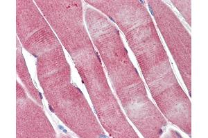Anti-PGAM2 antibody IHC staining of human skeletal muscle.