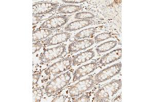 Immunohistochemical analysis of paraffin-embedded human colon tissue using (ABIN656890 and ABIN2846089) performed on the Leica® BOND RXm.