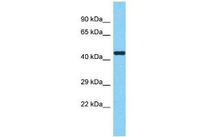Host: Rabbit Target Name: METTL17 Sample Type: HCT15 Whole Cell lysates Antibody Dilution: 1.