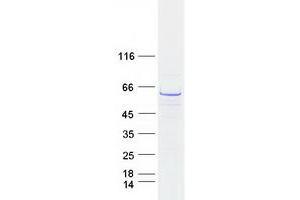 Validation with Western Blot