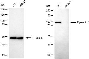 Western blotting analysis using dynamin 1 antibody (ABIN7798397). (Recombinant Dynamin 1 anticorps)