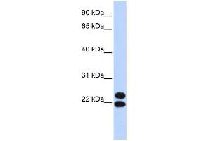 WB Suggested Anti-PRRX2 Antibody Titration:  0. (PRRX2 anticorps  (N-Term))