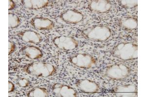 Immunoperoxidase of monoclonal antibody to CSE1L on formalin-fixed paraffin-embedded human colon. (Exportin 2 anticorps  (AA 872-971))