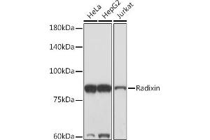 Western blot analysis of extracts of various cell lines, using Radixin Rabbit mAb (ABIN7269833) at 1:1000 dilution. (Radixin anticorps)