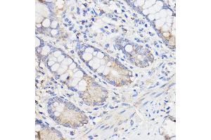 Immunohistochemistry of paraffin-embedded Human colon using WBSCR27 Rabbit pAb (ABIN7271366) at dilution of 1:50 (40x lens). (WBSCR27 anticorps  (AA 1-245))