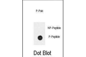 Dot Blot (DB) image for anti-Phosphinothricin N-Acetyltransferase (BAR2) (pSer261) antibody (ABIN3001865) (BAR2 anticorps  (pSer261))