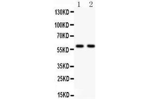 Anti- KAT13A antibody, Western blotting All lanes: Anti KAT13A  at 0. (NCOA1 anticorps  (AA 614-826))