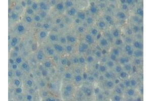 Detection of IGFBP7 in Rat Liver Tissue using Polyclonal Antibody to Insulin Like Growth Factor Binding Protein 7 (IGFBP7)