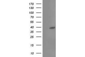 Western Blotting (WB) image for anti-TBC1 Domain Family, Member 21 (TBC1D21) antibody (ABIN1501313) (TBC1D21 anticorps)