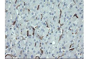 Image no. 1 for anti-Cyclin-Dependent Kinase Inhibitor 2B (p15, Inhibits CDK4) (CDKN2B) antibody (ABIN1497444)
