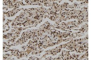 ABIN6260913 and ABIN6273210 at 1/100 staining Human lung tissue by IHC-P. (CNOT10 anticorps  (Internal Region))