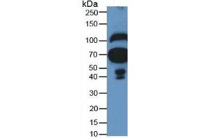 Mouse Detection antibody from the kit in WB with Positive Control: Human serum. (Fibulin 1 Kit ELISA)