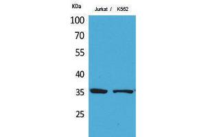 Western Blotting (WB) image for anti-Apurinic/Apyrimidinic Endonuclease 1 (APEX1) (Ser1423) antibody (ABIN3187837) (APEX1 anticorps  (Ser1423))