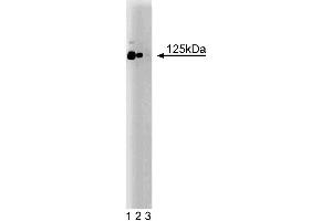 Western blot analysis of CD51 (Integrin alphaV) on a rat cerebrum lysate. (CD51 anticorps  (AA 609-722))