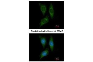 ICC/IF Image Immunofluorescence analysis of methanol-fixed HeLa, using STK25, antibody at 1:200 dilution. (STK25 anticorps)