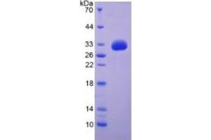 SDS-PAGE of Protein Standard from the Kit  (Highly purified E. (EGF Kit ELISA)