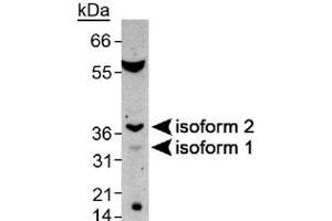Western blot analysis of SPDYA in mouse testis with SPDYA polyclonal antibody . (SPDYA anticorps  (AA 200-286))