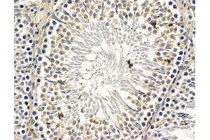 anti-DIS3-Like Exonuclease 1 (DIS3L) antibody