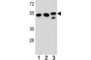 TUBB6 antibody western blot analysis in K562, HeLa, MDA-MB231 lysate.