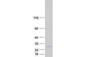 Validation with Western Blot
