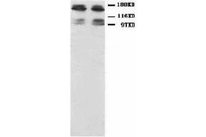 Image no. 1 for anti-Glutamate Receptor, Ionotropic, N-Methyl D-Aspartate 2B (GRIN2B) (N-Term) antibody (ABIN1494122) (GRIN2B anticorps  (N-Term))
