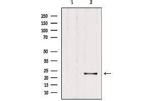 Western blot analysis of extracts from rat brain, using RAB9B Antibody.