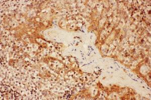 Anti- IL2RA antibody, IHC(P) IHC(P): Human Tonsil Tissue (CD25 anticorps  (N-Term))