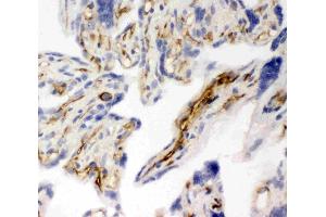 Anti-CD31 antibody, IHC(F): Human Placenta Tissue
