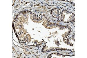 IHC analysis of MMP2 using anti-MMP2 antibody (ABIN7601677).