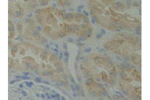 IHC-P analysis of Human Kidney Tissue, with DAB staining. (BMX anticorps  (AA 287-523))