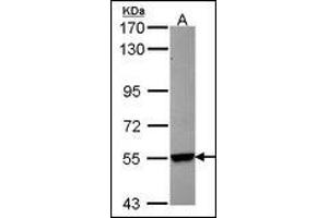 Sample (30 µg of whole cell lysate). (CYP26B1 anticorps)