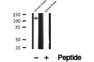 Western blot analysis of extracts of mouse brain tissue, using ATP8A1 antibody.