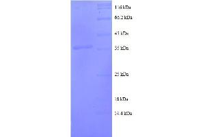 Chemokine (C-C Motif) Ligand 20 (CCL20) (AA 27-95), (full length) protein (GST tag)