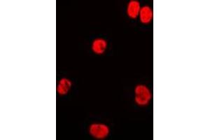 Immunofluorescent analysis of Lamin A/C staining in HeLa cells. (Lamin A/C anticorps  (Center))