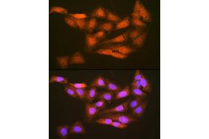 Immunofluorescence analysis of U-2 OS cells using PSMD14 Rabbit mAb (ABIN7269588) at dilution of 1:100 (40x lens).