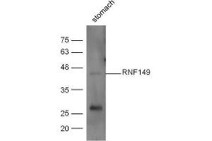 Mouse stomach lysates probed with Anti-RNF149 Polyclonal Antibody  at 1:5000 90min in 37˚C (RNF149 anticorps)