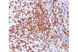 IHC testing of human tonsil stained with HCAM antibody (156-3C11).