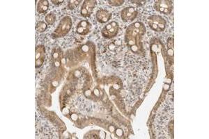 Immunohistochemical staining of human duodenum with NEO1 polyclonal antibody  shows moderate nuclear and cytoplasmic positivity in glandular cells at 1:10-1:20 dilution. (NEO1 anticorps)